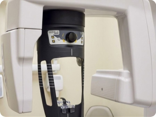 Digital X-Rays and Sensors