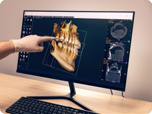 CBCT Cone Beam Technology